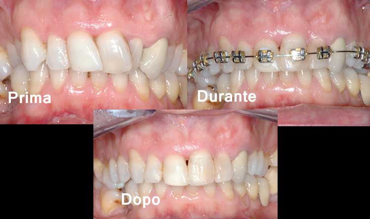 ortodonzia correzione sorriso pavia 